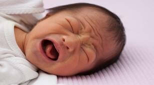 Kernikterus pada Bayi Bisa Sebabkan Cerebral Palsy