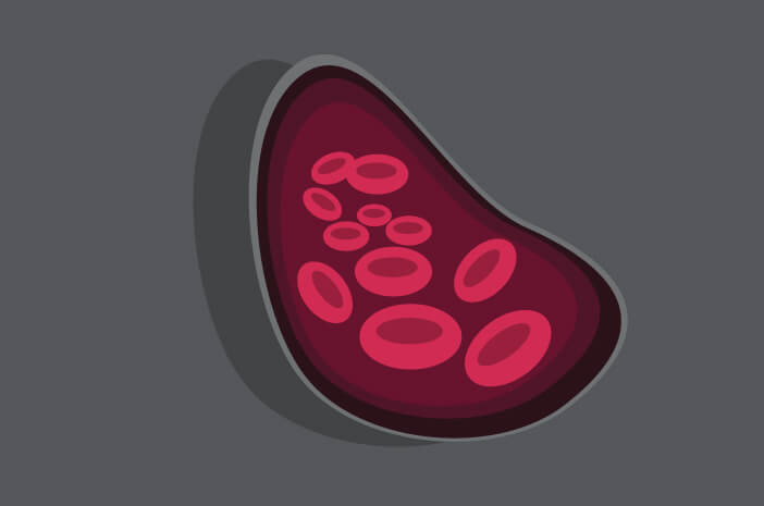 Ketahui Gejala Paroxysmal Nocturnal Hemoglobinuria (PNH)