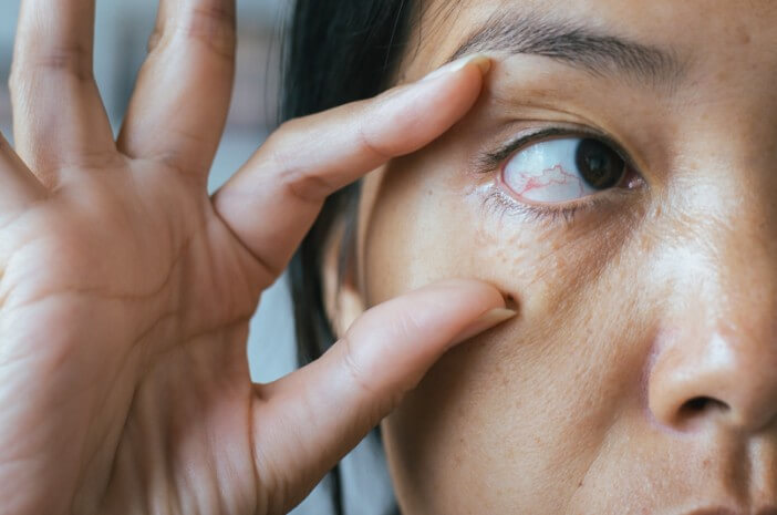 Ketahui 5 Komplikasi Akibat Alkaptonuria