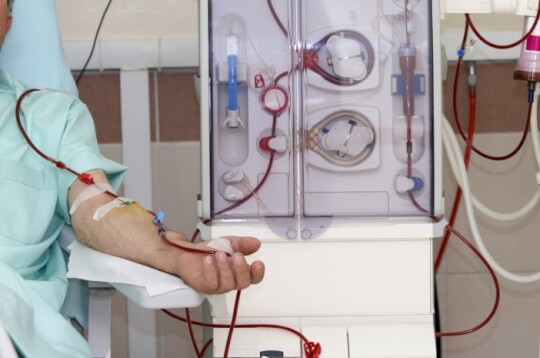 Ketahui Cara Kerja Cuci Darah pada Pengidap Gagal Ginjal