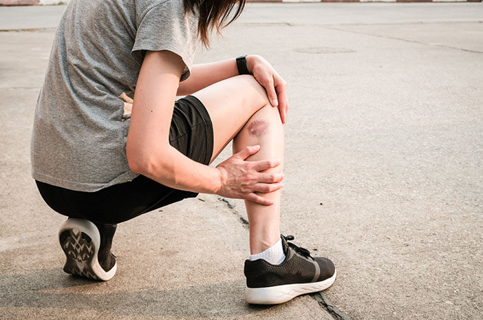 Komplikasi Erythema Nodosum yang Perlu Diketahui