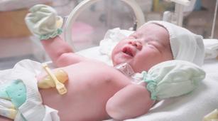 Kondisi Mata Bayi Prematur Bisa Dideteksi dengan Screening Retina, Benarkah?