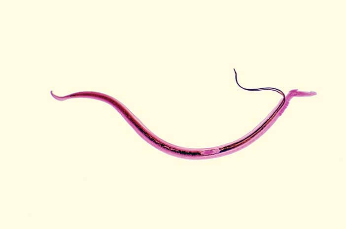Meski Langka, Kenali Gejala Munculnya Schistosomiasis