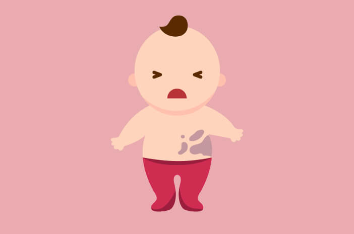 Muncul Bercak Mongol pada Bayi, Orangtua Tidak Perlu Panik
