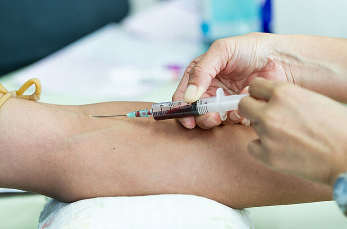 Pemeriksaan Kesehatan untuk Mendiagnosis Melena