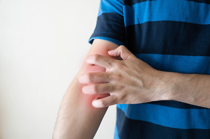 Pengidap Dermatitis Rentan Terkena Dermatographia, Benarkah? Pengidap Dermatitis Rentan Terkena Dermatographia, Benarkah?
