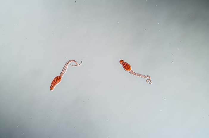 Pengobatan untuk Mengatasi Schistosomiasis