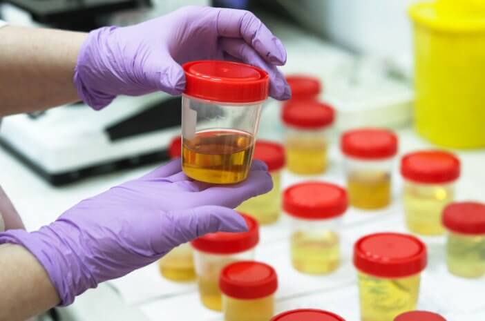 penjelasan-tentang-pemeriksaan-uroflowmetri-dan-cara-melakukannya-halodoc penjelasan-tentang-pemeriksaan-uroflowmetri-dan-cara-melakukannya-halodoc