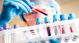 Peran Tes Hematologi Lengkap dalam Mendiagnosis Penyakit