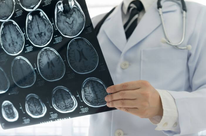 Perlukah CT Scan pada Tiap Trauma Kepala?