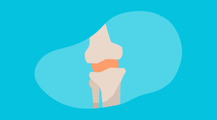Perlu Tahu, Prosedur Arthrocentesis untuk Diagnosis Septic Arthritis