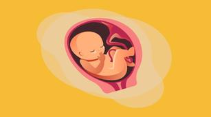 Kelahiran Prematur Tingkatkan Risiko Retensi Plasenta
