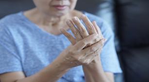 Penyakit Rheumatoid Arthritis - Gejala, Penyebab, Dan Cara Mengobati ...