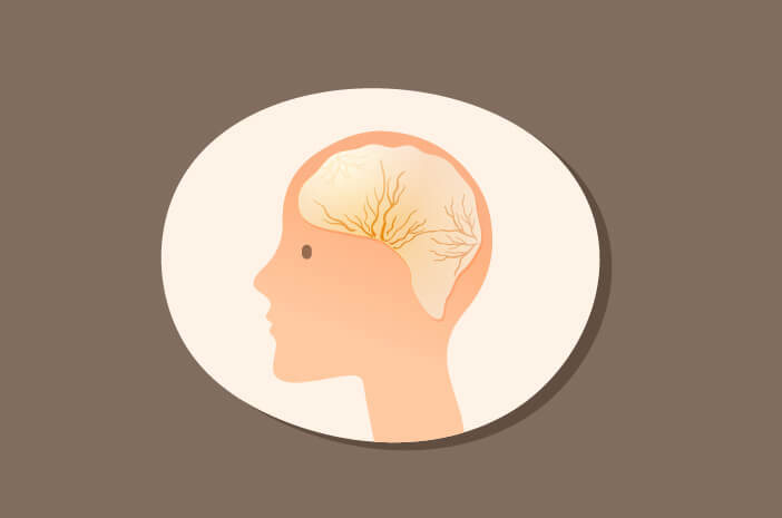 hematoma subdural, jenis trauma kepala hematoma subdural, jenis trauma kepala
