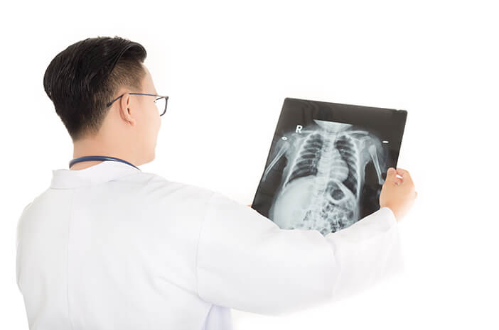 Terdengar Mirip, Ini Bedanya Osteopetrosis dan Osteoporosis