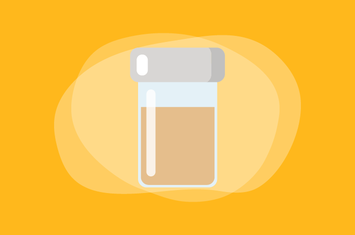 Tes Urine Dibutuhkan untuk Diagnosis PNH, Ini Penjelasannya Tes Urine Dibutuhkan untuk Diagnosis PNH, Ini Penjelasannya