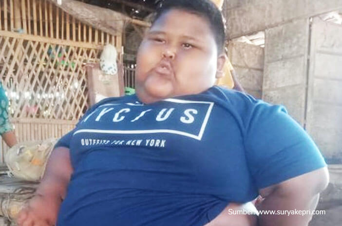 Viral Anak Obesitas Meninggal Karena Asma, Ini Penjelasan Medisnya Viral Anak Obesitas Meninggal Karena Asma, Ini Penjelasan Medisnya