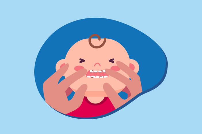4 Gejala dari Baby Bottle Tooth Decay